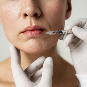 de-la-mituri-la-naturalete,-noua-abordare-in-estetica-buzelor