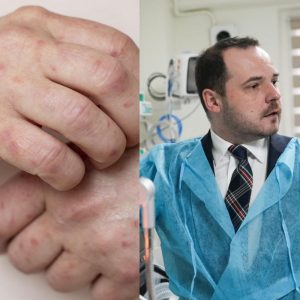 a-fost-confirmat-al-doilea-caz-de-lepra-la-cluj!-de-unde-au-luat-boala-femeile,-de-fapt.-ministrul-sanatatii-explica-ce-trebuie-sa-stie-clientii-lor-de-la-salon:-se-face-ancheta-epidemiologica-extinsa