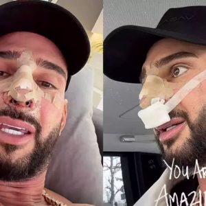 dorian-popa-a-fost-operat-de-urgenta-la-nas,-iar-interventia-a-durat-6-ore:-mi-a-scos-o-bucata-de-vreo-5-centrimetri-din-coasta,-ca-sa-poata-repara-tot