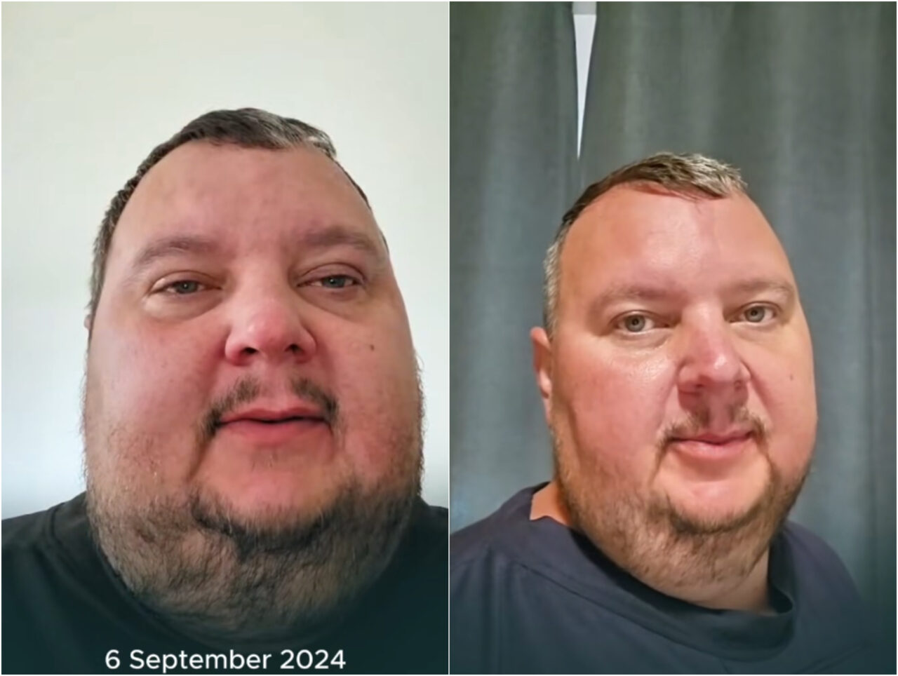 transformarea-ireala-a-unui-barbat-din-marea-britanie-obisnuia-sa-bea-12-litri-de-cola-si-sa-manance-2-paini-pe-zi.-cum-arata-dupa-ce-a-slabit-187-kg