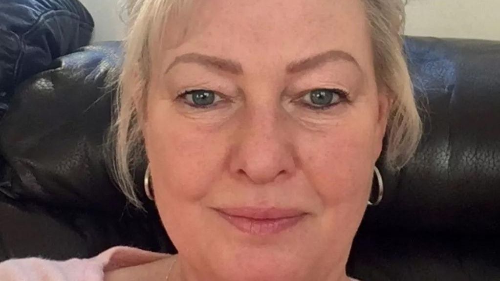 o-femeie-a-murit-de-rabie-la-patru-luni-dupa-ce-a-fost-muscata-de-un-caine,-desi-rana-era-superficiala.-simptomele-care-au-indus-o-in-eroare-pe-femeie